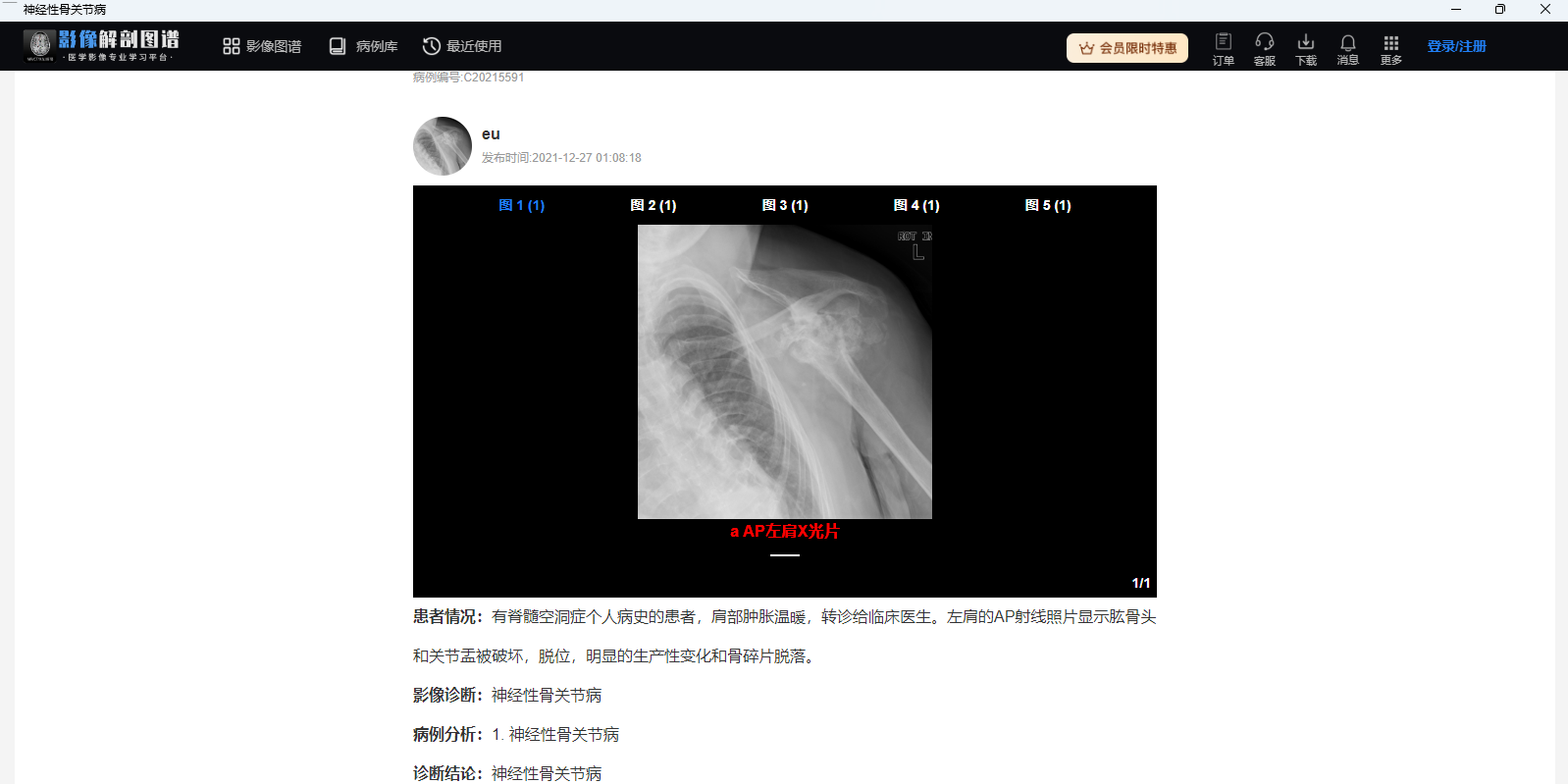 影像解剖图谱32位